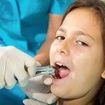 Tooth Extractions Irving