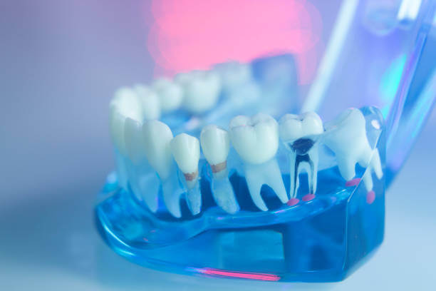 Dental Teeth Mouth Gums - Dentists Teaching Model