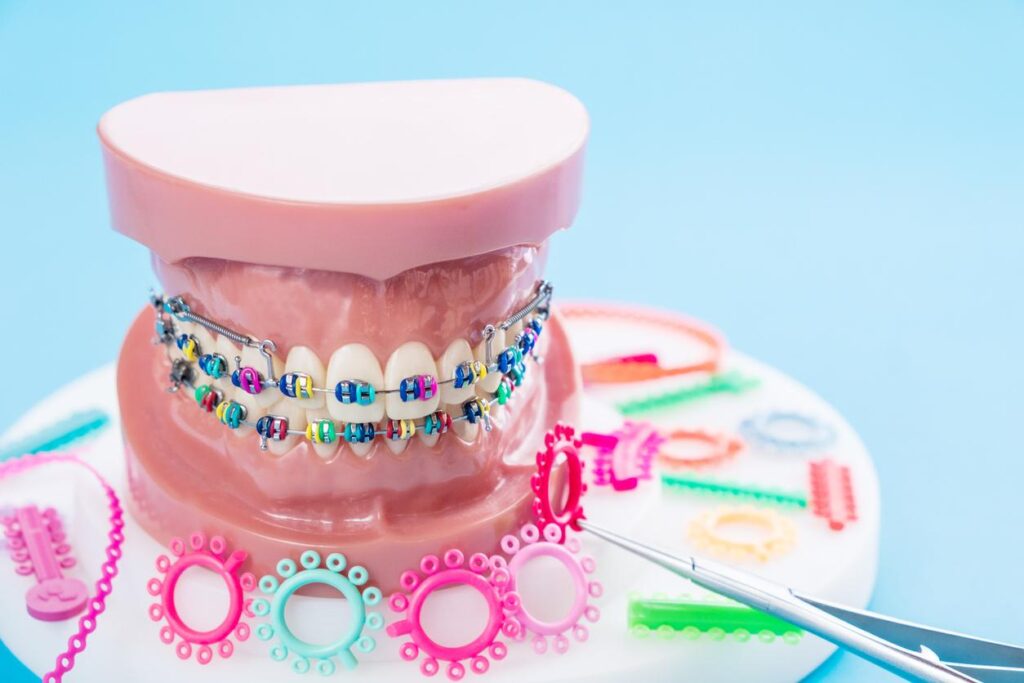 orthodontic-model-and-dentist-tools