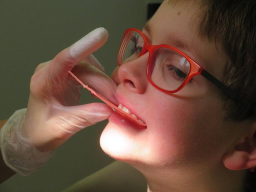 young child with braces